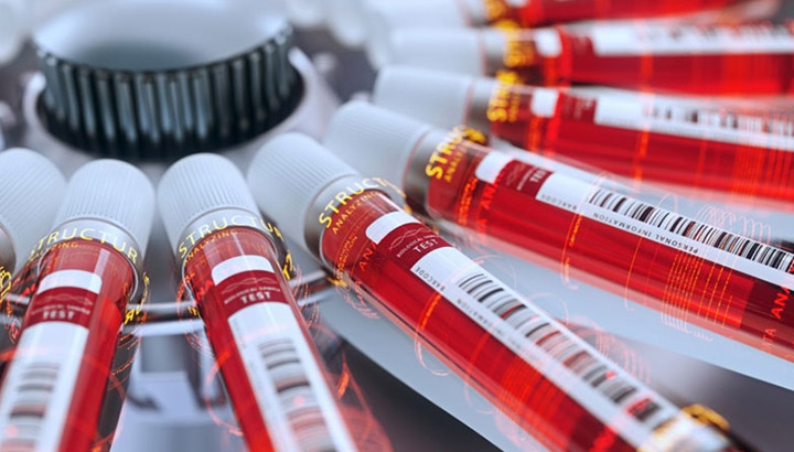 Toepassing van sentrifugasie in farmaseutiese bedryf